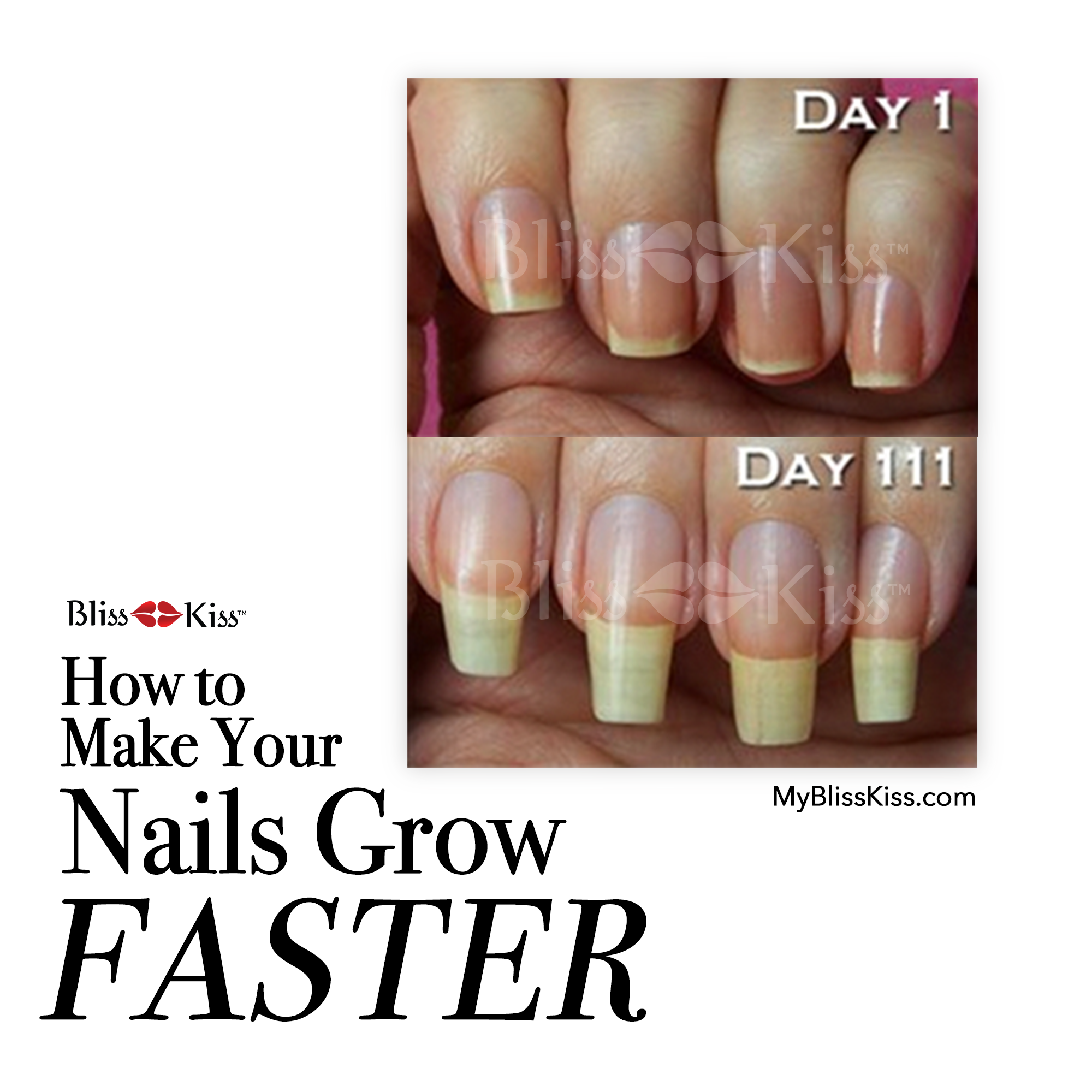How to Make Your Nails Grow FASTER!