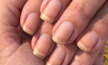 Are Clear Nails Bad?