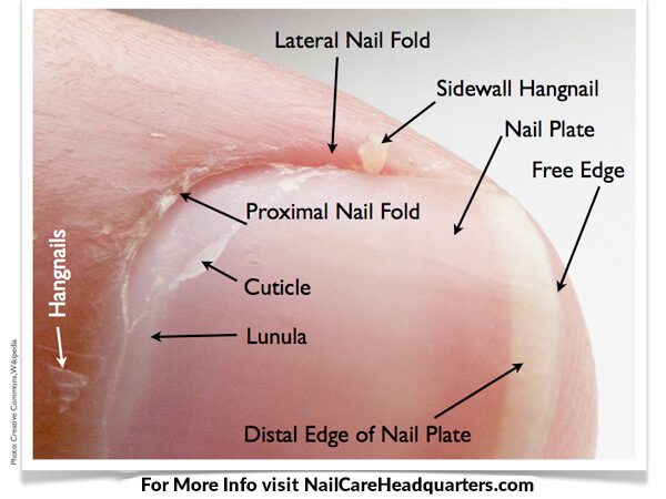 HANGNAIL TREATMENT: Ask Ana - Dealing With Hangnails