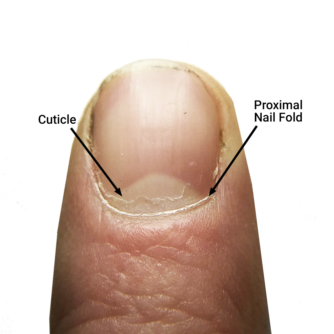 The Cuticle – Should You Clip, Push, or Scrape?