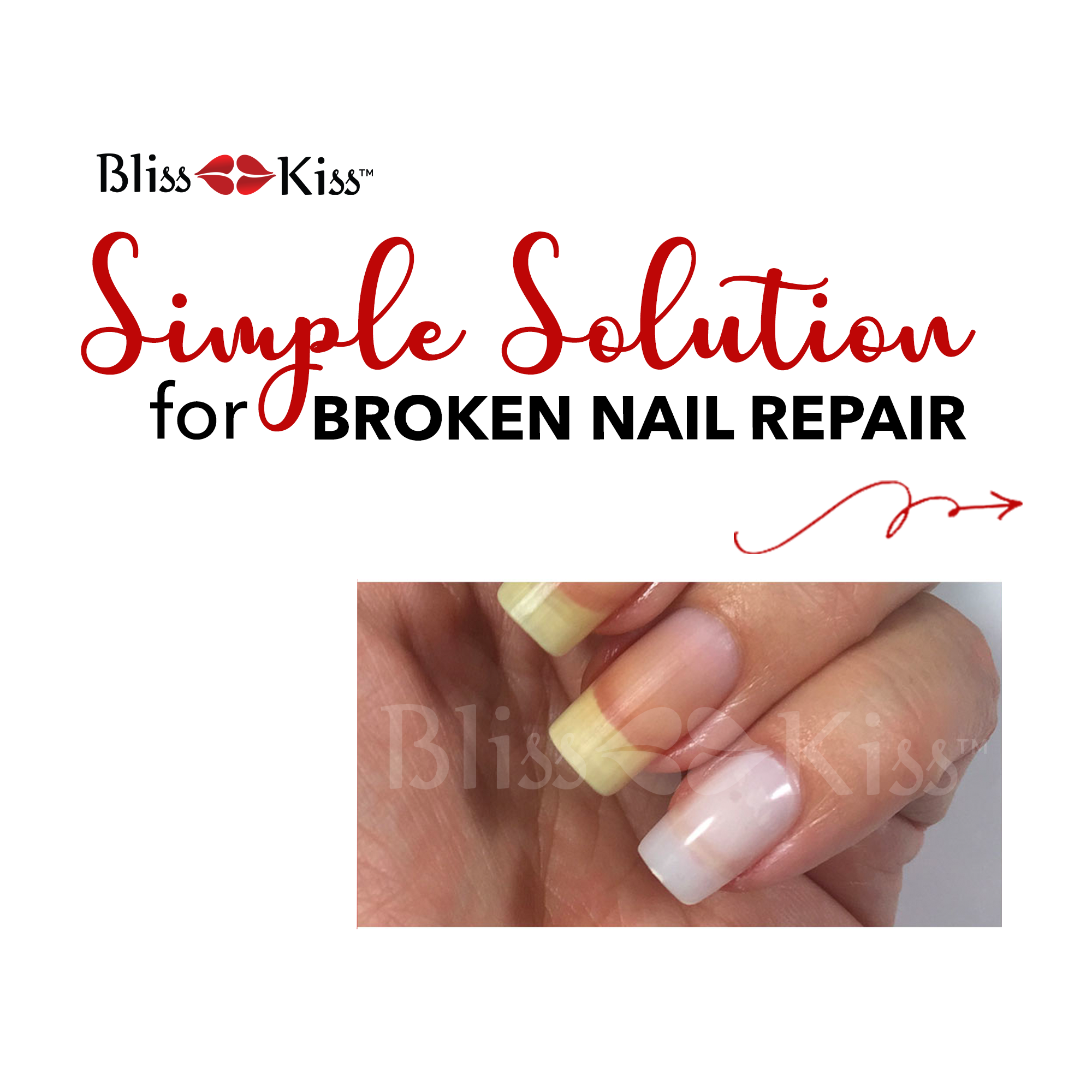 A Simple Solution for Broken Nail Repair
