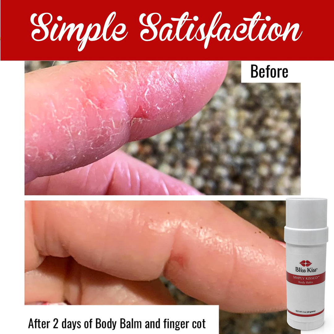 Simply Kissed™ Ultra Hydrating Body Balm