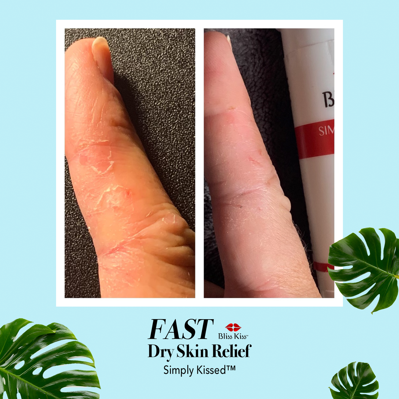 Simply Kissed™ Ultra Hydrating Body Balm