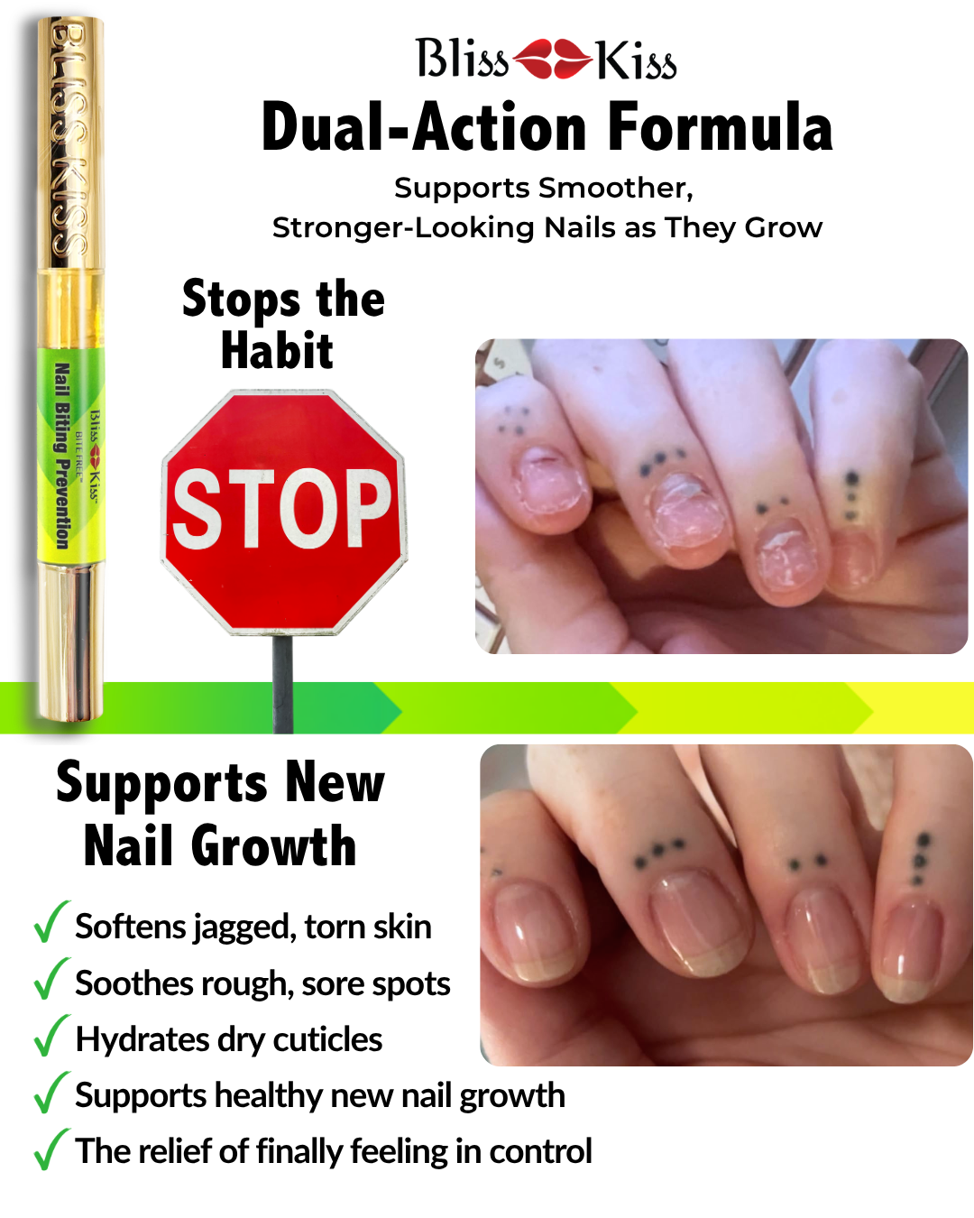 Bite Free™ Nail Biting Prevention | Simply Pure™ Nail & Cuticle Oil Bitter Formula