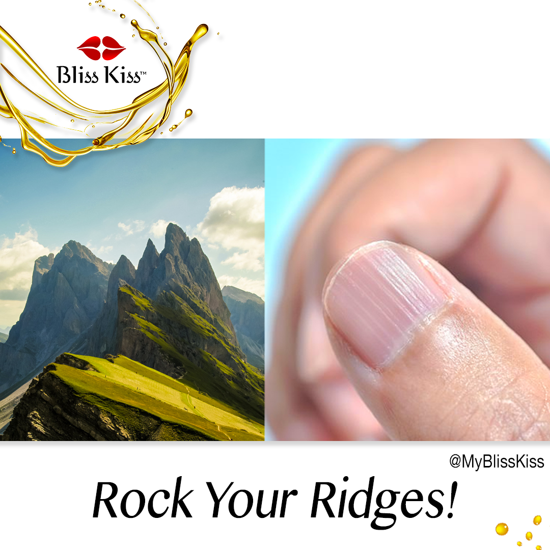 Ridges in Nails—ASK ANA