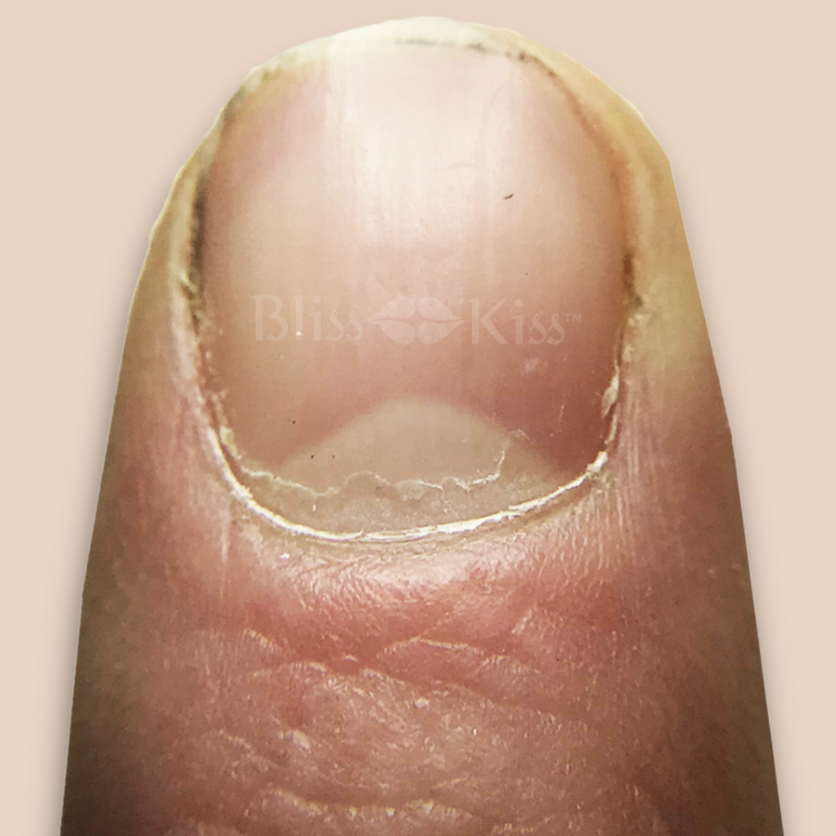 Cuticula Normal Cuticle Care