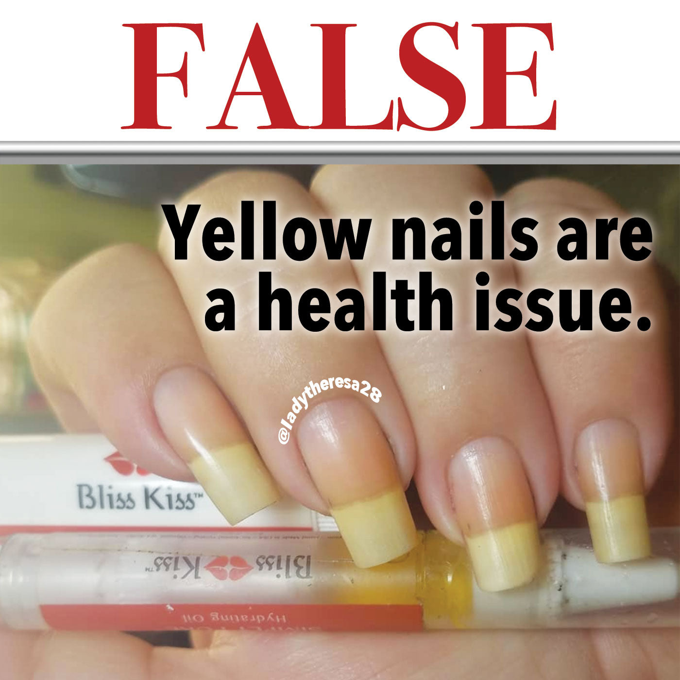 Image depicts healthy nails with a soft tint of yellowing to the nails. they are grasping a cuticle nail oil pen. The text overlaying the image reads. 
FALSE "yellow nails are a health issue"
around the ring finger nail a watermark reads "@ ladytheresa28"