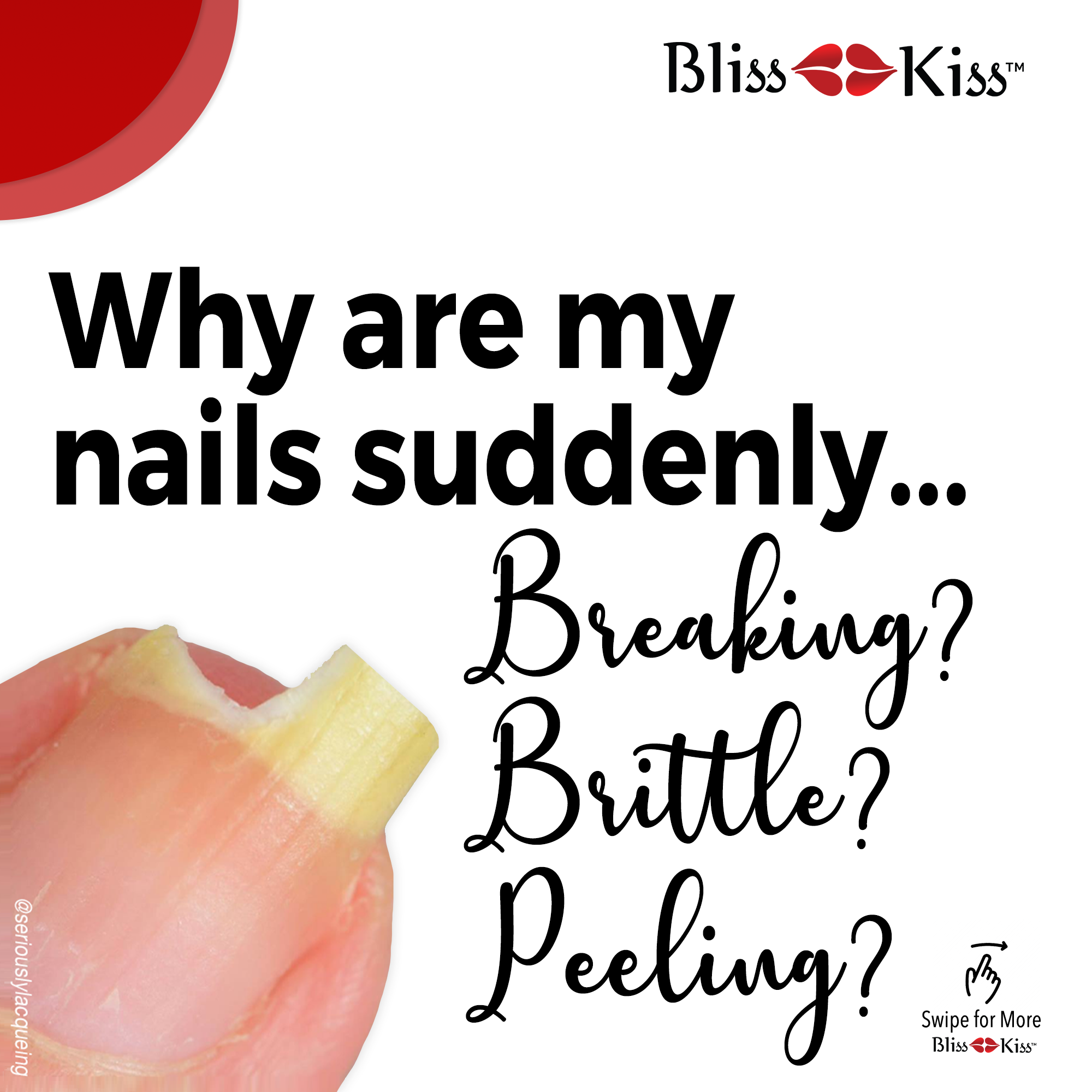 Bliss Kiss
Image text reads. "Why are my nails suddenly..." And in curly cursive "Breaking? Brittle? Peeling?"
With a photo of a nail with a large chunk of missing nail at the top.