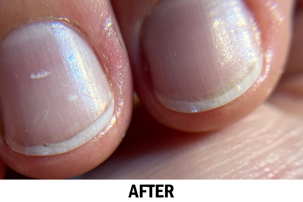 Image shows short yet very healthy nails. Well nourished and oiled. with bottom text "after"