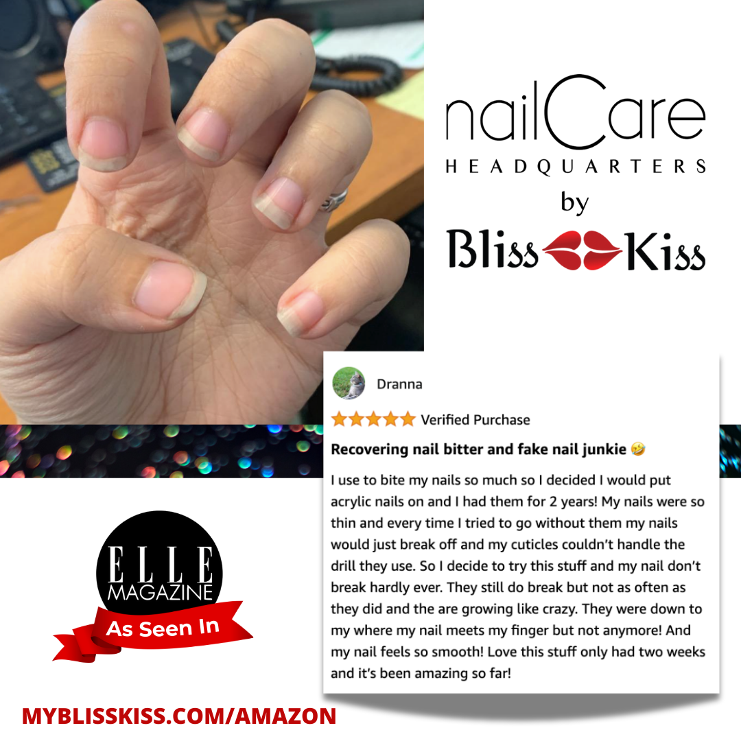 Image shows a photo of nails with fresh growth. The amazon review reads: 
Dranna
"Recovering nail biter and fake nail junkie"
crying laughing emoji
" I used to bite my nails so much so I decided I would put acrylic nails on and I had them for 2 years! My nails were so thin and every time I tried to go without them my nails would just break off and mu cuticles couldn't handle the drill they use. So I decided to try this stuff and my nails don't break hardly ever. They still do break but not as often as the-"