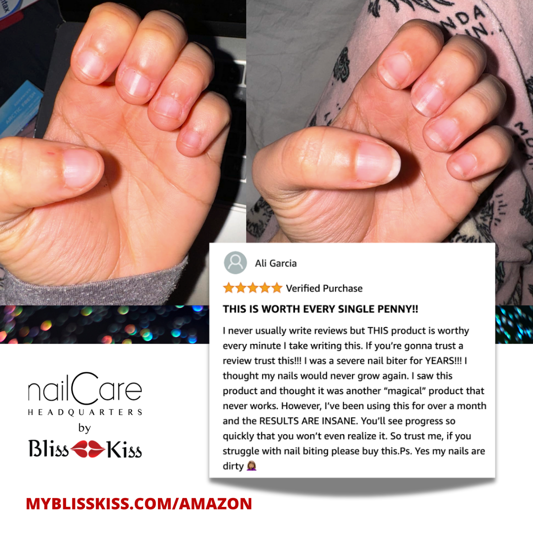 Image shows two photos of two different hands. the one on the left shows a hand that is red in the nail area. the nails are bitten down completely. The right side shows the same hand healed. No agitated color and healthy clean nails freshly grown. 
The amazon review reads: Ali Garcia
"THIS IS WORTH EVERY SINGLE PENNY!!!
I never usually write reviews but THIS product is worth every minute I take writing this. If you're gonna trust a review trust this!!! I was a severe nail biter for YEARS!!!"