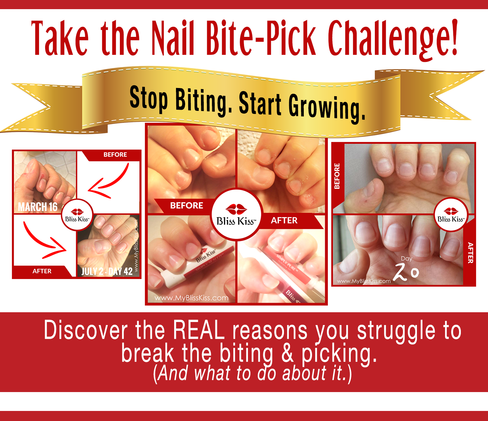 How To Stop Biting Nails - Tips To Stop Biting Your Nails – DeBelle  Cosmetix Online Store
